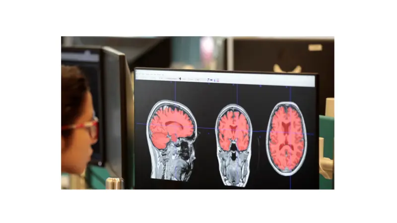 Using AI To Advance Imaging Operations & Analysis in Phase III Clinical Trials for Alzheimer’s
