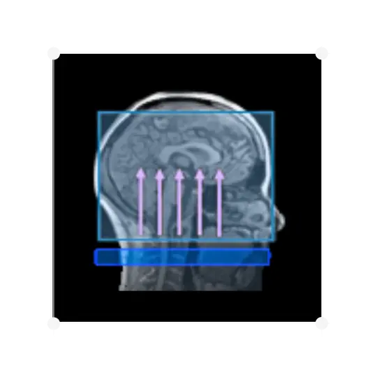 Arterial Spin Labelling (ASL)